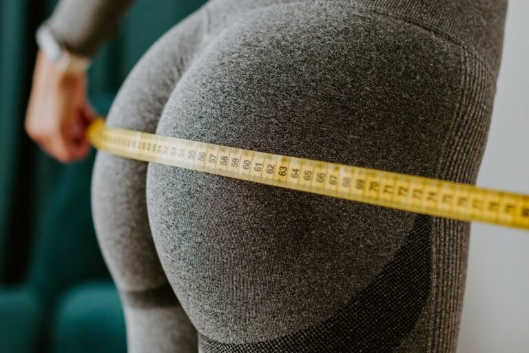 aplicacao de PMMA nos gluteos